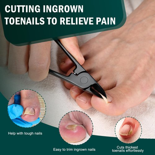 FVION Toenail Clippers for Thick Nails - Nail Clippers Toenail Nipper, Wide Jaw Nail Trimmer, Slight Curved Blade Pointed Tip Ingrown Toenail Tool