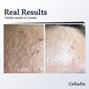 Celladix Acne Control 131 Gel Cleanser | Acne Treatment | 99% Propionibacterium Acnis Removal | 0.5% Salicylic Acid Cleanser for Oily Skin | Hydrates Skin | Glycerin FREE Acne Cleanser | 3.71 Fl Oz