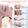 HOFASON 4Pcs Pedicure Foot Files Callus Remover with Double Sided, Professional Foot Scrubber for Feet at Home or Salon Care, Can Be Used On Both Dry and Wet Feet for Dead Skin (Pink&White)