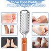 Professional Foot Scrubber Dead Skin Remover, Pedicure Foot File Callus Remover, Heel Scraper for Cracked Heels, Grater for Feet, Foot Rasp for Hard Skin(T1)