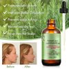Rosemary Oil for Hair Growth, Rosemary Essential Oil, 100% Pure Natural, Reduce Hair Loss, Deeply Nourishing Scalp, Improves Blood Circulation
