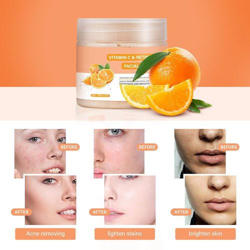 Vitamin C and Retinol Facial Scrub Face Scrub Exfoliating Face Wash Vitamin C Facial Body Scrub Microdermabrasion Facial Scrub Face Exfoliate Exfoliator for Blackhead Ingrown Hair KP Bump Eraser 3.5OZ