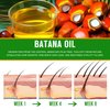 Batana Oil for Hair Growth.Rich in Essential Fatty Acids, Antioxidants, Vitamin E. Vegan Thickening, Moisturizing, Strengthening Serum For Women, Men. Scalp Treatment For Weak, Dry Hair 2.02 fl.oz