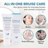 EpiRepair Premium Bruise Cream - Formulated with Clinically Proven Arnica Oil & Vitamin K to Help Lessen & Remove Bruises in Cosmetic Surgery Procedures - Enhanced with Emu Oil, Vitamin E & Green Tea