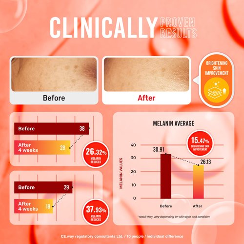 Koji White Pure Kojic Acid Skin Brightening Soap | Glycerin Soap Bar for Exfoliating Face with Tea Tree, Coconut Oil | Sun Damage Skin with Hyaluronic Acid, Vitamin C, Vegan, 2.82 oz (Pack of 2)