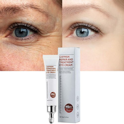 Pinnoocy Magic Eye Cream, Instantly Remove Under Eye Bags Wrinkles Puffiness Dark Circles and Fine Lines, Anti Aging Eye Cream for Men Women