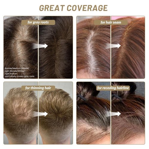 SOVONCARE Hairline Powder, Hairline Shadow Gray Hair Coverage Touch Up Hair Powder for Thinning Hair for Women Hair Root Touch Up Powder Hair Root Cover Up Conceals Hair Loss Brown 0.35 oz