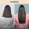 Moerie Volumizing Shampoo and Conditioner for Hair Loss - Thickening Products with Ingredients of Natural Origin - Over 100 Active Ingredients for Thick, Long, Luscious Hair, 2 X 8.45 Fl Oz