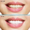 Professional Strength Teeth Whitening Strips 28 Count - 14 Day Supply + Bonus Shade Guide