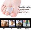 Welnove - 10 Pack Toe Separators Gel Toe Spacers Bunion Corrector（1st/2nd Toe) and Spreader for Bunions, Overlapping Toes and Drift Pain Relief Pads - Clear