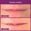 PRAI Beauty Ageless Lip and Line Filler for Instantly Ageless Lips | Lip Serum that Plumps, Smooths, & Fills In Lines | Moisturizing Lip and Line Filler with Vitamins C & E to Boost Collagen