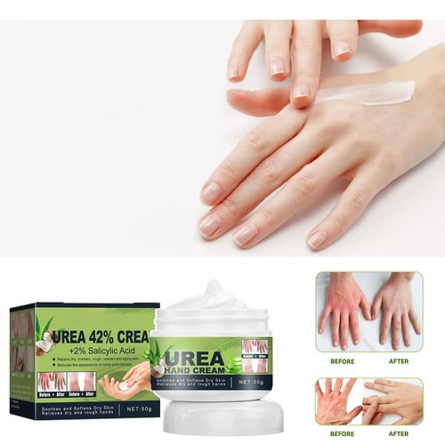 42% Urea 2% Salicylic Acid Hand Foot Cream - Plant Ingredients Urea Cream Moisturizing and Hydrating Working Hands Cream Cracked Heel Treatment Urea Cream for Feet