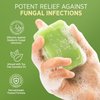 Roycederm Antifungal Antibacterial Tea Tree Soap: Antifungal Antibacterial Treatment for Face & Body Acne, Athlete's Foot, Tinea, Folliculitis Ringworm Jock Itch (Pack of 1)