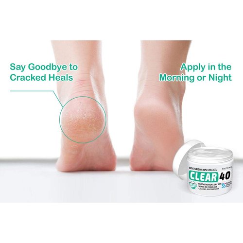 CLEAR 40 Urea Cream 40 Percent for Feet Maximum Strength (4oz) | Softens Cracked Heels & Dry Skin Urea Cream 40 Percent - Tea Tree & Coconut Oil | Urea Cream for Callus & Corn Treatment | Made in USA