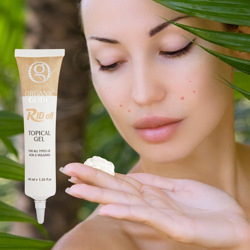 All - Natural Organic Acne Treatment Topical Gel Containing Dead Sea Mineral Salt – Best Acne Scar Removal Cream for Your Face - Ideal For Dry, Oily, Sensitive Skin – 1.35 FL oz. Per Tube