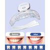 MySmile Teeth Whitening Kit with led Light, 28X Teeth Whitening Strips for Teeth Sensitive, 10 Min Fast Whitening , Helps to Remove Stains from Coffee, Smoking, Wines(1Pcs Light + 14Sets Strips)