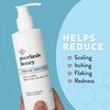 PSORIASIS HONEY Renewing Conditioner - Dry Scalp Treatment - Psoriasis Cream for Dry Hair - Coconut Oil Hair Moisturizer Helps Relieve Symptoms of Eczema, Dandruff, Dermatitis & More (8oz)