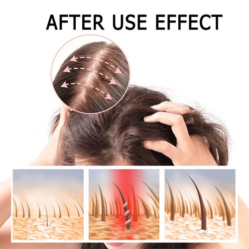 JISKG Ginger Plant Extract Anti-Hair Loss Hair Shampoo for Hair Growth, 2 Boxes (400g) , Oil Control Hair Care for Women and Men