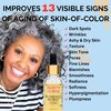 No Needles, No Way!™ Anti Aging Serum for Skin-of-Color, Wrinkles Dark Spots Hydrate Smooth Even Tone Retinol Hyaluronic Acid Beauty of the Nile® 1 Oz