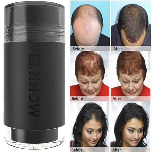 MINNOW Hair Building Fibers,Keratin Hair Fibers Hair Loss Concealer For Thinning Hair Powder Volumizing Based,16grams/0.56oz (GRAY)