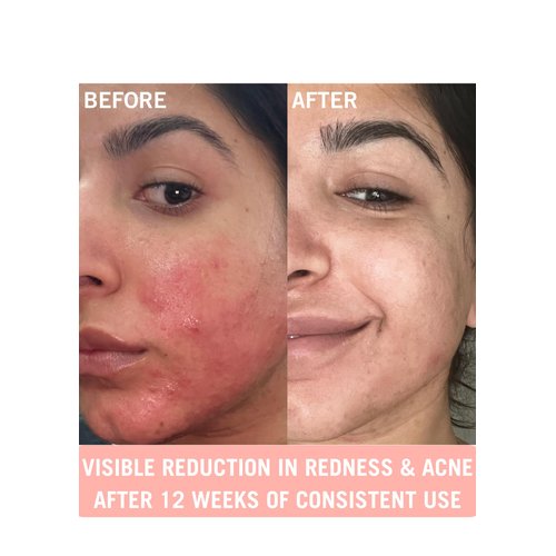 Mudita Earth Organic Skin Cleanser: Peach Leaf and Basil Acne, Vitamin C Cleanser for Acne, Natural and Gentle Cleanser Face Wash for Sensitive Skin with Moringa Oil