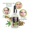 AICHUN BEAUTY Face Serum Soothes Moisturizing Anti-Acne Repair Facial Skin Care 30ml