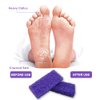 BPrettier Foot Pumice Stone Disposable Pumice Stone for Feet Foot Scrubber Sponge Callus Remove Dead Skin,Pedicure Supplies Nail Salon Home Use 40 PCS