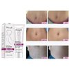 RtopR Mango Stretch Marks and Scar Cream -Stretch Marks and Scar Removal Cream for Pregnancy - Best Body Moisturizer-40g