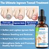 Ingrown Toenail Treatment w/Ingrown Toenail Drops Reliever & Softener,Double Sided Pedicure Nail Lifter Tool for Easy Trimming Care Thick Nail & Ingrown Toe Nail,Toenail Cleaner Kit for Men Women