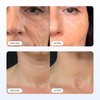 Original Glamory Radiant Flawless Skin Micro Infusion Kit - At Home Facial System Beauty Tool Skin Care for Face | 0.25MM Needle
