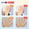 Warticide Fast-Acting Wart Remover - Plantar and Genital Wart Removal, Attacks Warts On Contact, Easy Application (2 Bottles)