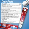 MED Pride Hydro Cortisone (Hydrocortisone) Cream 1% OTC Bulk Pack of 4 X 1 Oz Anti-Itch Ointment for Rash, Eczema, Bug Bites