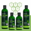 Tea Tree Shampoo and Conditioner Set - Dandruff Treatment With Organic Tea Tree Oil - Itchy Scalp Treatment for Women and Men - Sulfate and Paraben Free With Manuka Honey, Aloe Vera & Coconut (16oz)