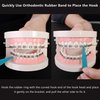 20 Pcs Dental Elastic Rubber Bands Placers for Braces, Disposable Plastic Orthodontic Elastic Placers Multi-color