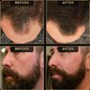 Hairline Powder by The Beard Struggle, Root Touch Up Hair Color, Hair Concealer for Men Instantly Conceals Hair Loss, Baldr's Arrow - Covers Thin Hair & Bald Spots - Sweat Resistant - Dark Brown