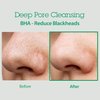 BLITHE AHA BHA Cleanser - Deep Pore Cleanser and Pore Minimizer, Exfoliant for Face, For Clogged Pores, 5.07 Fl Oz