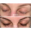 Biotin Lash Serum - Eyelash & Eyebrow Growth Serum. Eyelash & Eyebrow for Thick Lashes and Brows Korean Dermatologist-Conceived 0.35oz