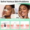 Blackhead Mask for Pore, Blackhead Remover Peel off Mask, Nose Plants Pore Cleanser, Refreshing Pore Mask with 100 pcs Strips (1.7oz)