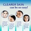 Clear Pimple Patches for Face | Hydrocolloid Pimple Patches Salicylic Acid Tea Tree Oil Calendula Oil | Acne Patch Zit Stickers | Acne Dots for Skin Care