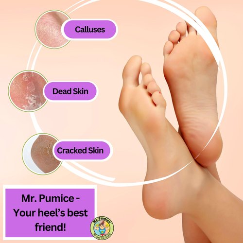 Mr. Pumice Callus Remover PUMI Bar: Pedicure Stone & Foot/Heel Scrubber - Coarse Grit (4 Pack)