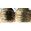 Rootflage Instant Blonde Root Touch Up - Temporary Hair Color and Concealer for Thinning Hair (04 WARM BLONDE)