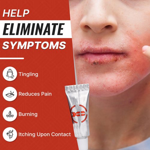 Cold Sore Treatment for Lips and Blister Prevention - Made in USA - 1.7% Menthol Lip Balm - Fast Cold Sore Treatment Medicated Lip Balm - 1 Day Cold Sore Treatment & Fever Blister Treatment for Lips