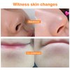 AICHUN BEAUTY Peel-Off Facial Mask Deep Cleansing Oil & Dirt Pores Face Skin Recover Vitamin A & E 120ml/4.05fl.oz (VITAMIN C HONEY PEEL-OFF MASK)