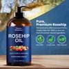 Rosehip Oil for Face 8 fl oz - Gua Sha Oil - Facial Oil for Gua Sha Massage - Rose Hip Oil - Rosehip Seed Oil - Aceite de Rosa Mosqueta