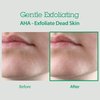 BLITHE AHA BHA Cleanser - Deep Pore Cleanser and Pore Minimizer, Exfoliant for Face, For Clogged Pores, 5.07 Fl Oz