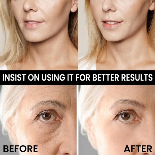 lisade Face Lifting Cream, Face Lifting Cream Tightening Lifting Sagging Skin, Eye, Neck, Face Tightening, Lifting & Firming,Face Moisturizer Hydrating Skin Cream,50g (2PCS)