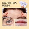 Yeokoe Forehead Wrinkle Patches,Under Eye Patches and Lip Mask 30 PCS.Facial Patches Set Face Masks Skincare Wrinkle Patches With Retinol Serum For Puffy Eyes and Dark Circles
