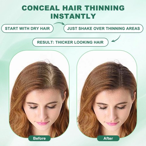 Hair Fibers (12g), Hair Fibers for Thinning Hair, Hair Building Fibers, Hairpiece Filler, Increase Hair Density, Styling Powder for Women & Men, Hair Makeup, Premium Formula Thickening (DARK BROWN)