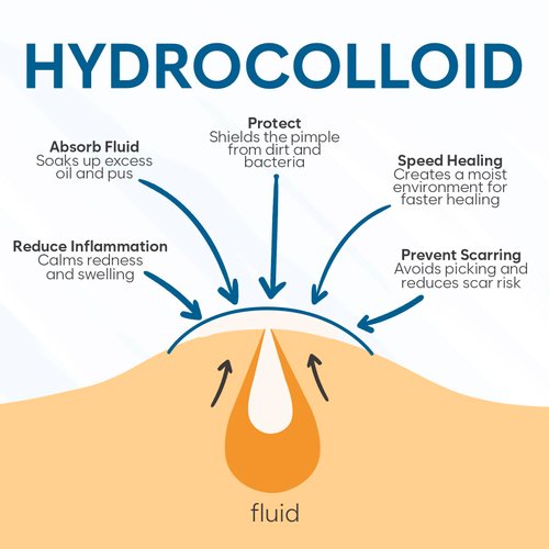 BLOOMORA Invisible Pimple Patches for Face (180 Count), Hydrocolloid Patch for Acne Spot Treatment, Acne Treatment for Face, Acne Patches, Zit Patches for Acne, Pimple Patch (S/L)