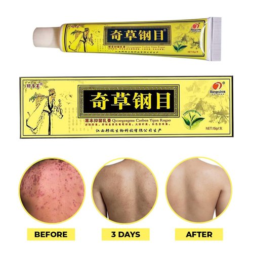 QICAOGANGMU Official Seller - Chinese Herbal Cream - Natural Relief for Skin Issues - Pack of 3